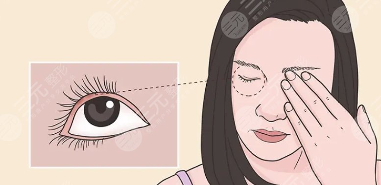 眼下干紋