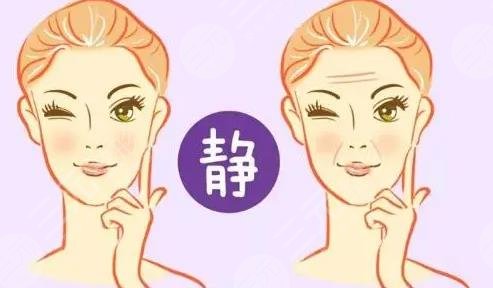 內(nèi)窺鏡除皺