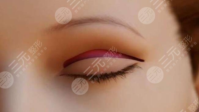 雙眼皮