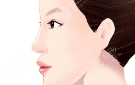 肋骨鼻