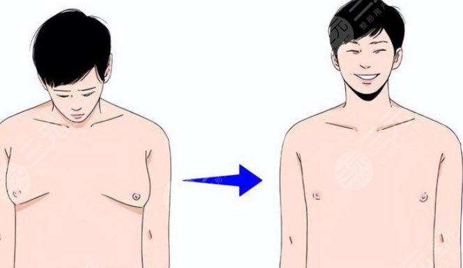 男生胸部肥肉怎么減03.jpg