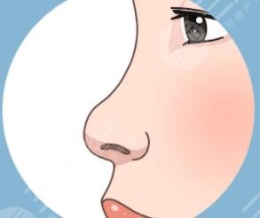 隆鼻