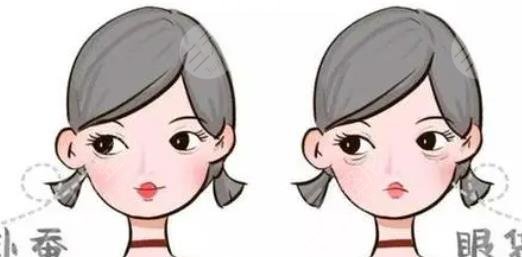 眼袋