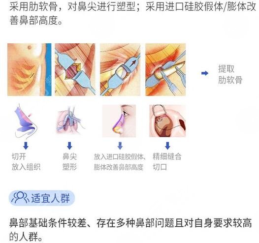 肋骨