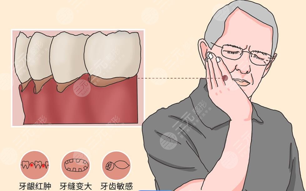 牙齦萎縮