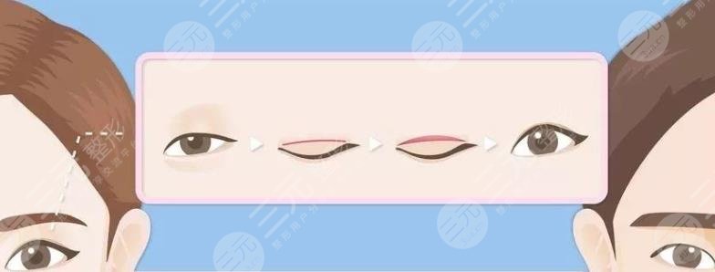 張余光醫(yī)生