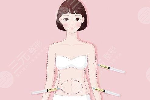 吸脂