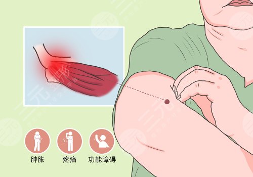 佛山市三水區(qū)人民醫(yī)院整形外科怎么樣