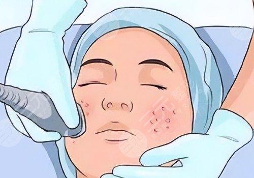 佛山市第二人民醫(yī)院醫(yī)學(xué)美容科祛斑多少錢