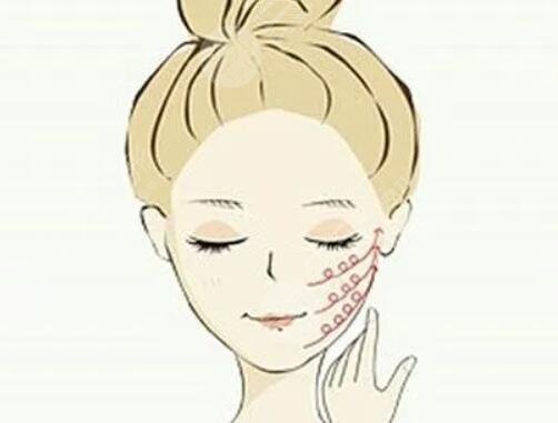 瘦臉針