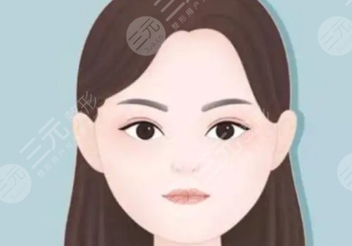 輪廓固定是什么手術(shù)