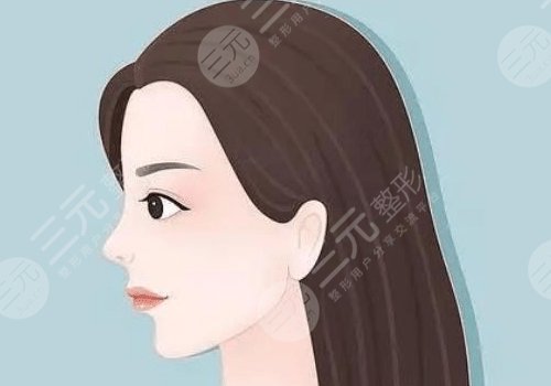 墊下巴整形多少錢