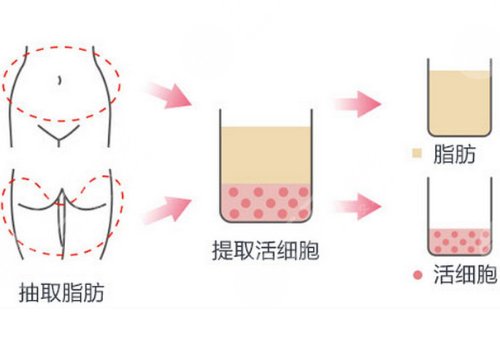 佛山整容醫(yī)院排行榜前十
