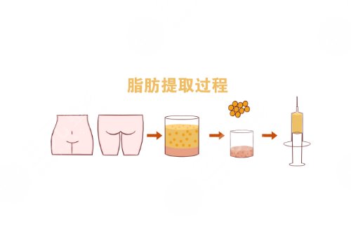 做一次醫(yī)美大概多少錢