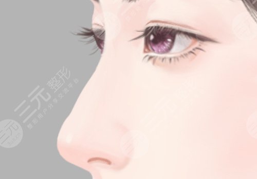 譚鶩遠(yuǎn)醫(yī)生鼻修復(fù)