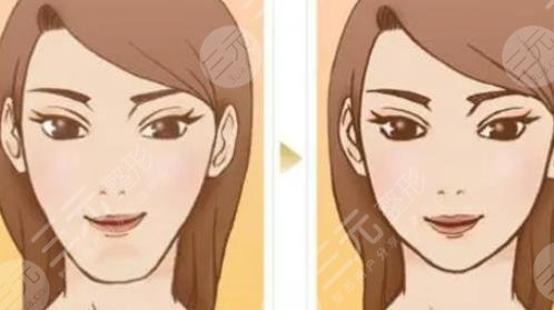 墊下巴