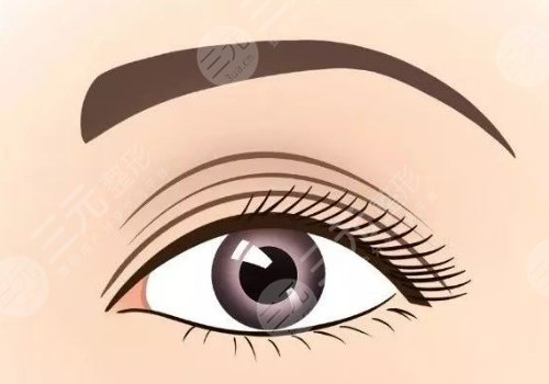 譚鶩遠(yuǎn) 雙眼皮案例