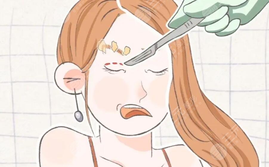 雙眼皮