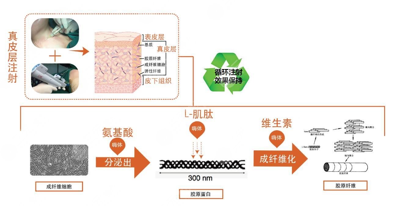  嗨體2.5的副作用和危害