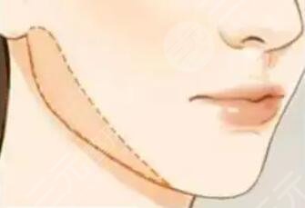 下頜緣