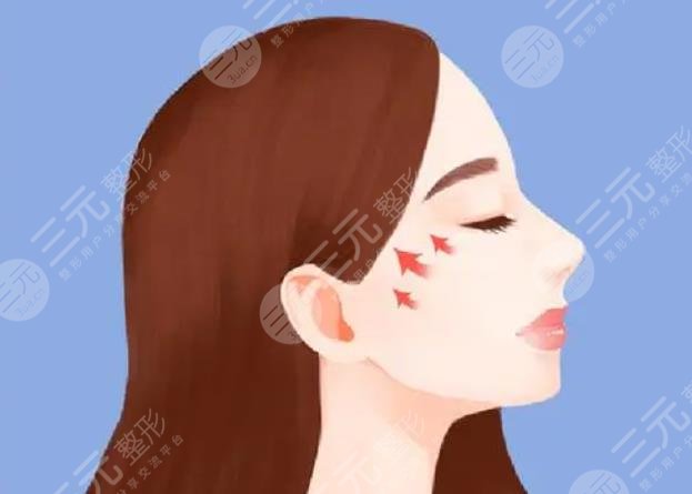 顴骨
