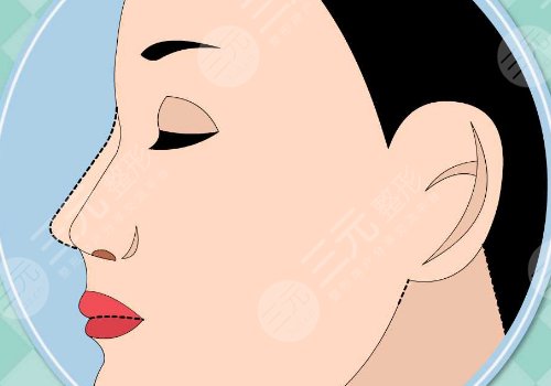 賈德淵做的鼻子怎么那么貴