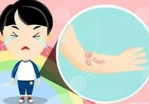 蘇州附二院祛疤怎么樣