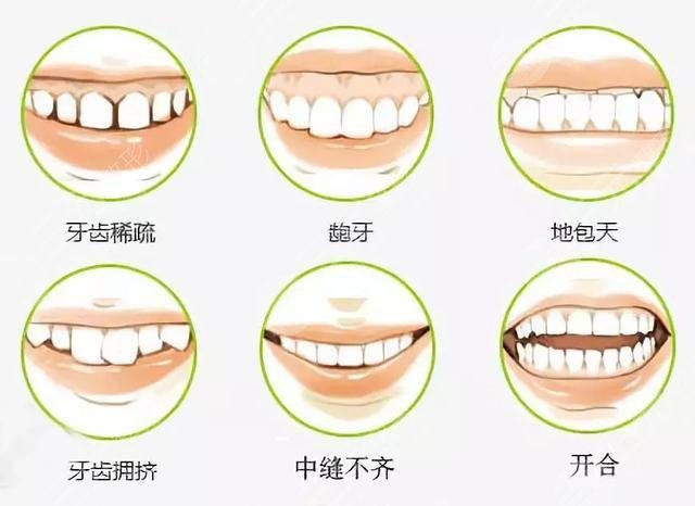 33歲地包天還能矯正嗎