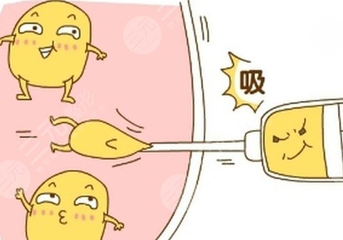大腿抽脂疼嗎