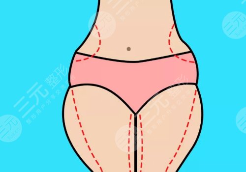 大腿抽脂疼嗎