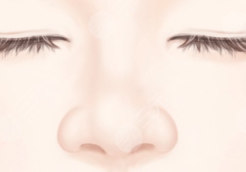 高順福,鼻整形手術(shù),費(fèi)用