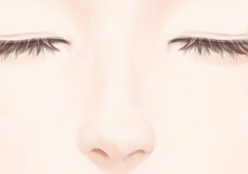 高順福,鼻整形手術(shù),費(fèi)用