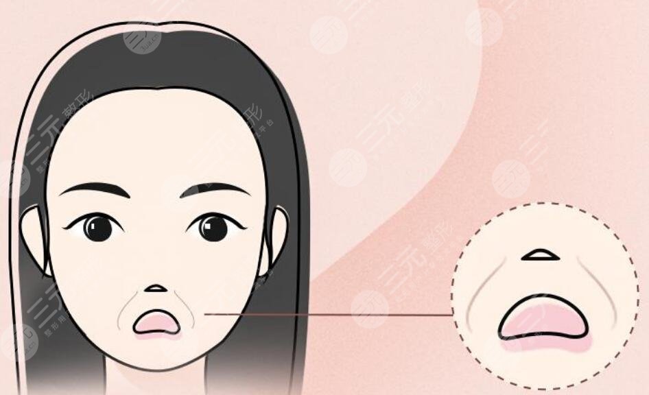 法令紋