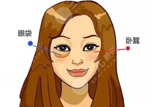 昆醫(yī)大附二院去眼袋掛哪個科