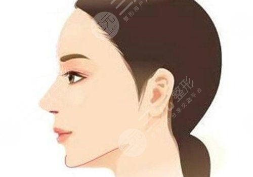 墊下巴哪種方式安全