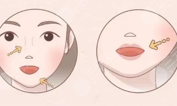 豐唇