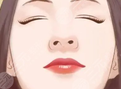 隆鼻