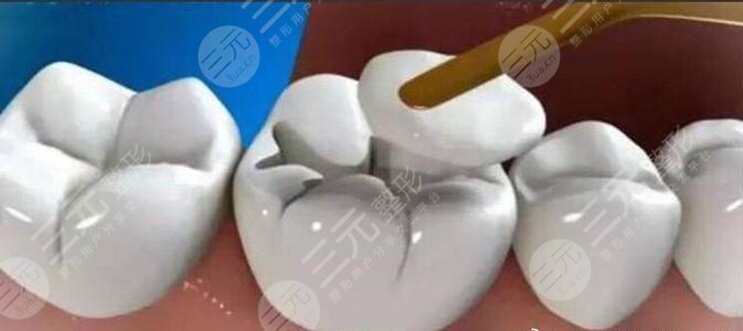 杭州第二人民醫(yī)院口腔科