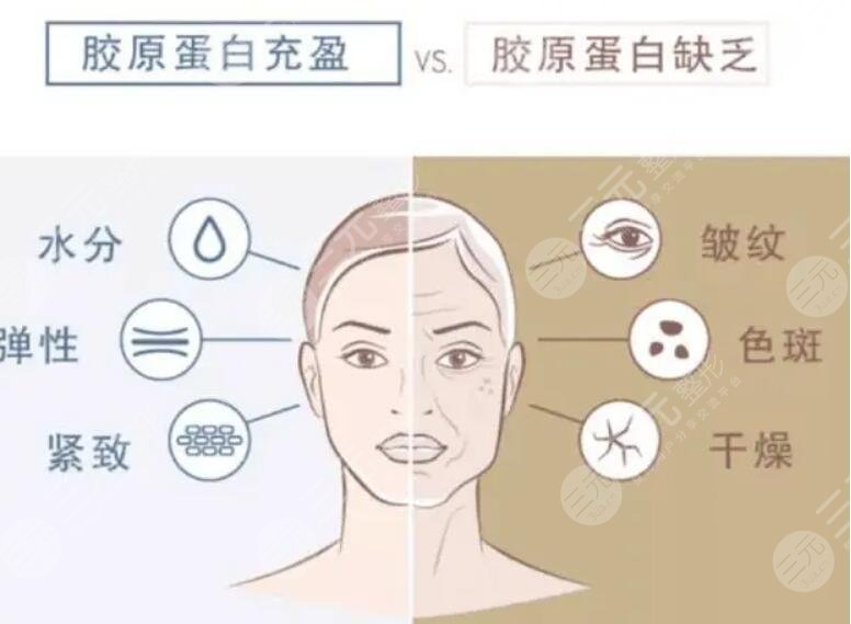 膠原蛋白