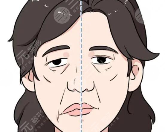 臉歪嘴斜