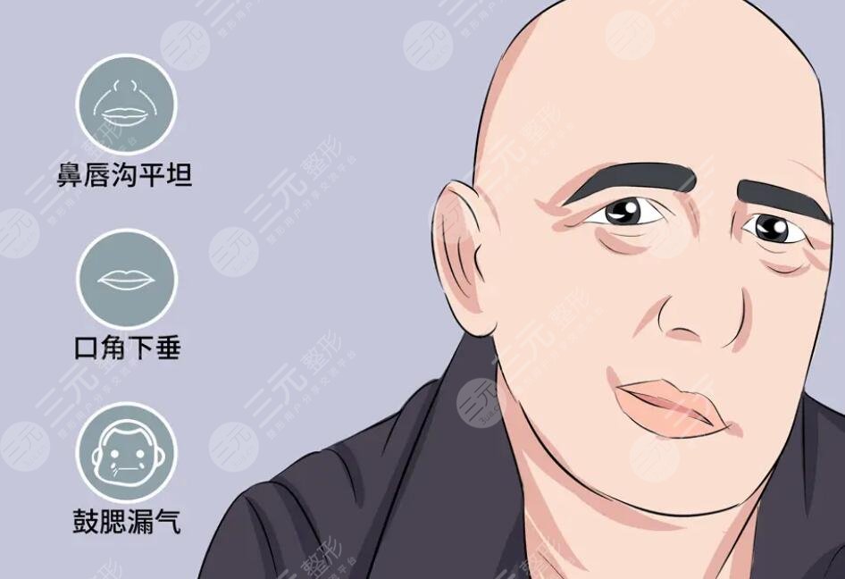 臉歪嘴斜