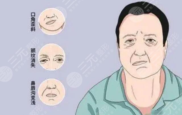 臉歪嘴斜