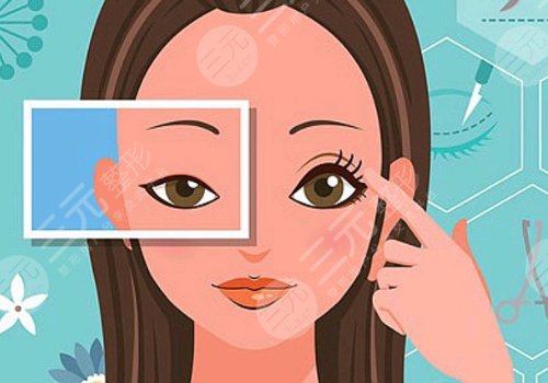 懷化美蒂珂整形醫(yī)院雙眼皮哪個醫(yī)生好