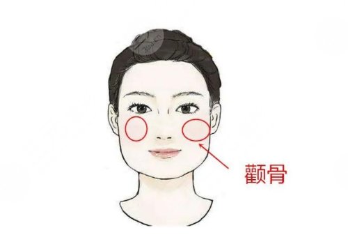 顴骨磨骨手術(shù)有后遺癥嗎