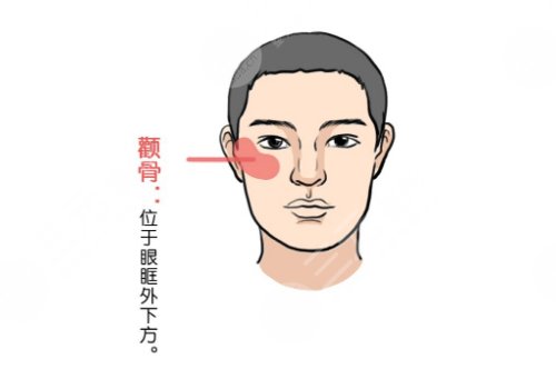 顴骨磨骨手術(shù)有后遺癥嗎