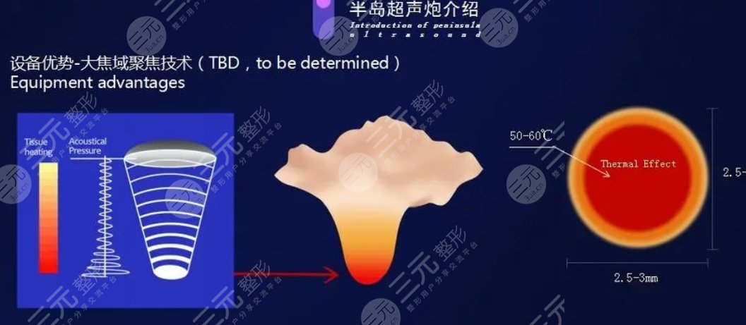 超聲炮
