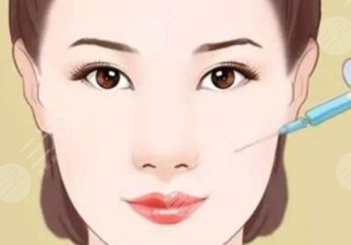 溫州粉范整形醫(yī)院打玻尿酸填充蘋果肌怎么樣