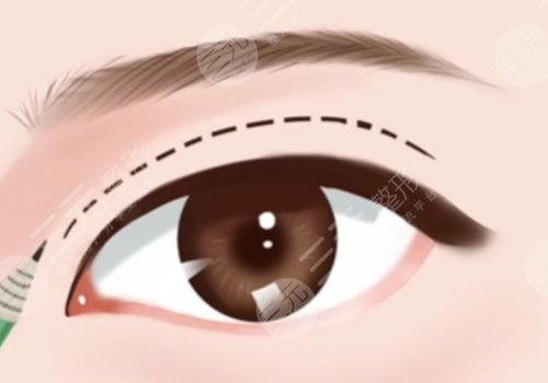 河南中醫(yī)藥大學第一附屬醫(yī)院整形外科趙絳波