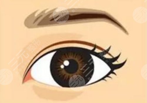 雙眼皮兩個(gè)月可以修復(fù)嗎