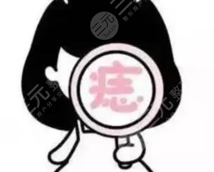 祛痣